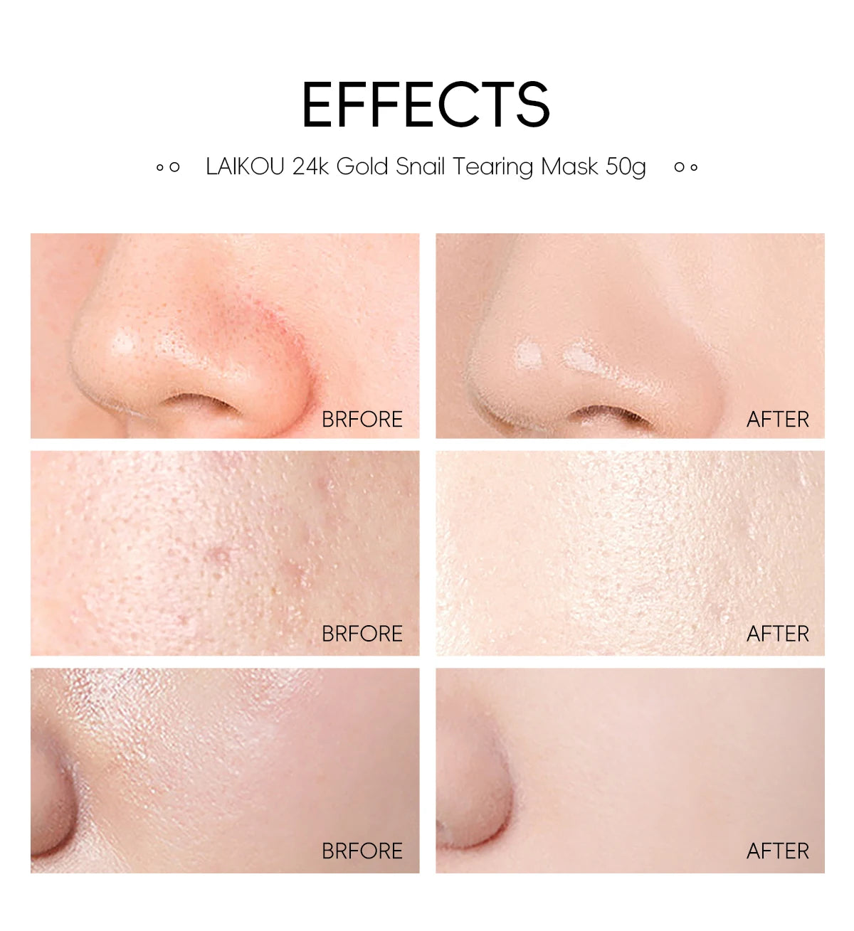 LAIKOU 24K Gold Snail Peel-Off Mask 3PCS Deep Cleansing Pore Tightening Blackhead Removal Detoxifying Facial Treatment 50g